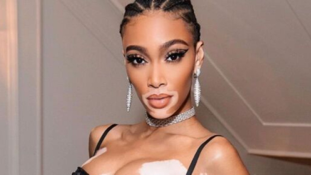 Taglio capelli corti e tonalit&agrave;: le scalature, il rosso e il ramato per l'autunno 2020.