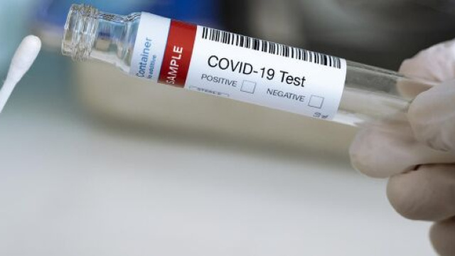 Coronavirus, 37.242 nuovi casi e 699 decessi oggi 20 novembre.