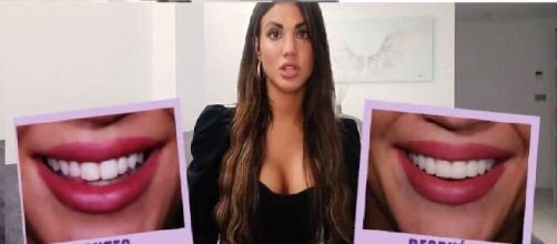 Melodie Pe&ntilde;&aacute;lver se ha puesto carillas en los dientes para mejorar su sonrisa.