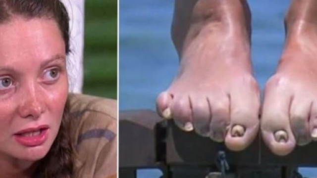 Alexandra r&eacute;pond &agrave; la pol&eacute;mique concernant ses pieds - Photo montage