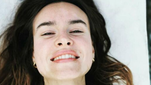 Kasia Smutniak: in un'intervista a Vanity Fair l'attrice parla della vitiligine che l'ha colpita sette anni fa.