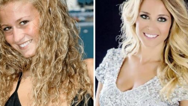 Diletta Leotta prima e dopo i ritocchi estetici