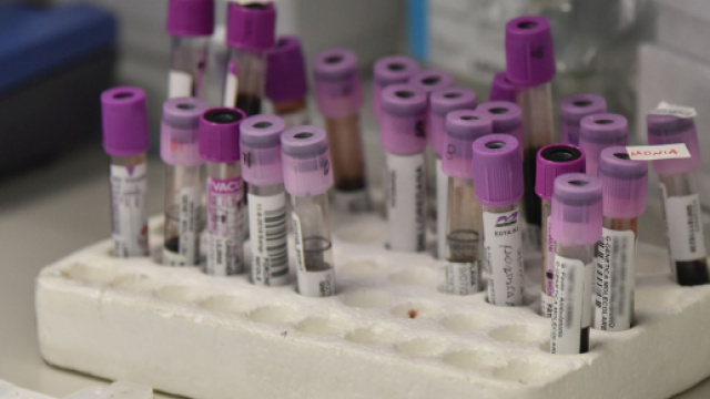 Coronavirus, dal Pascale di Napoli speranze per una cura