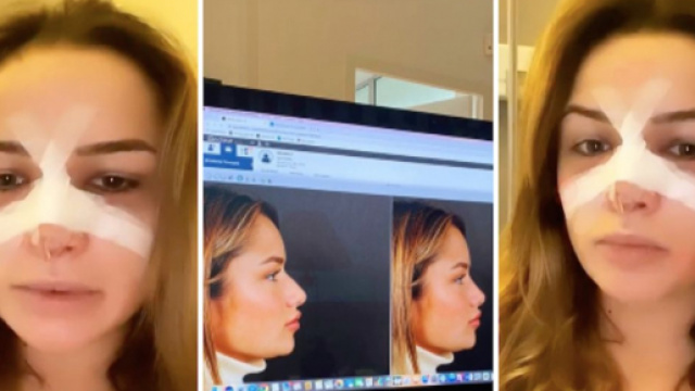 LMAC : Victoria M&eacute;hault s'est faite refaire le nez. Credit : Instagram/ victoia_m&eacute;hault