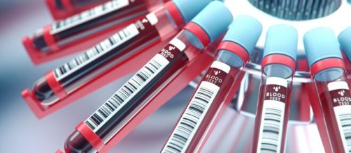 Detectar 13 tipos de c&aacute;ncer con un gota de sangre - 65ymas.com