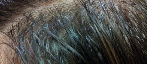 Consejos para cabello graso. Recup&eacute;ralo ya.