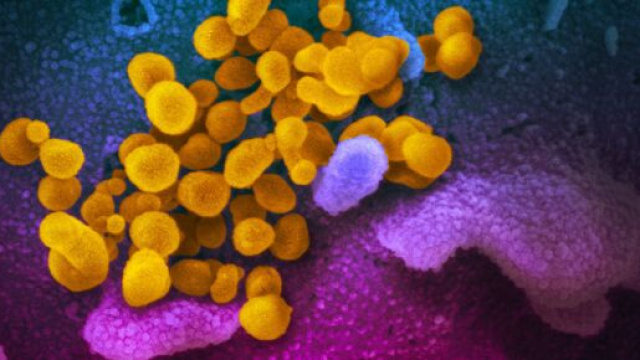 Immagine al microscopio elettronico a scansione del SARS-CoV-2 (giallo), noto anche come 2019-nCoV.