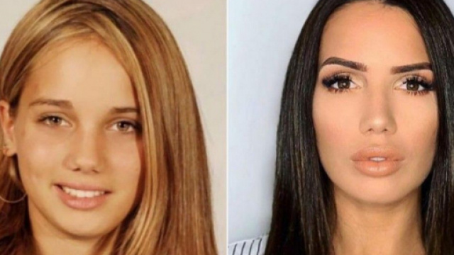 Manon Marsault ( Les Marseillais aux Cara&iuml;bes) accus&eacute;e d'avoir trop faire de chirurgie esth&eacute;tique, elle met les choses au clair.