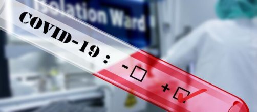 Photograph of COVID-19. [Image Source: geralt; Pixaby]