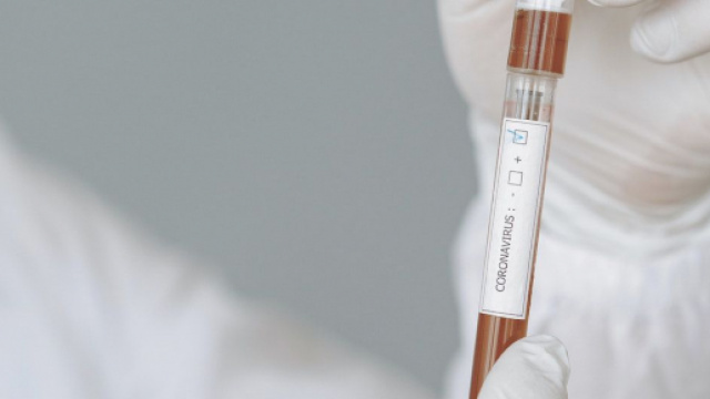 Coronavirus : Le flou persiste autour de l'immunisation des personnes affect&eacute;es. Credit : Gustavo Fling/Pexels