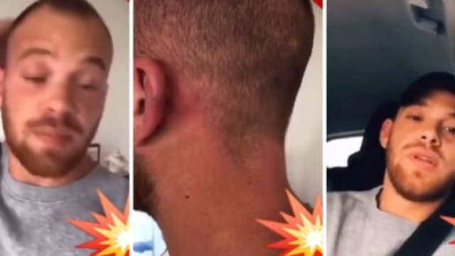 Fred s'est s&eacute;par&eacute; d'Eddy et l'accuse de violence