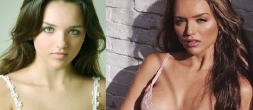 Rafa Kalimann fez diversos procedimentos ao longo dos anos. (Foto: Montagem/Instagram).