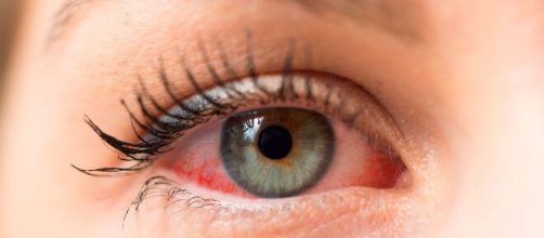 Coronavirus y conjuntivitis: dos nuevos estudios sugieren una relaci&oacute;n