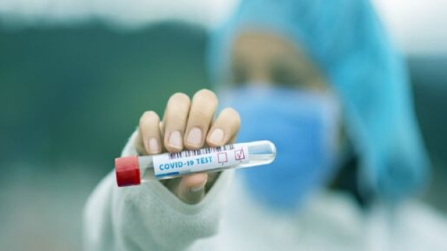 Anche la multinazionale farmaceutica di Basilea ha il suo test anti-Covid-19. Ha appena ricevuto l&rsquo;approvazione dalla FDA statunitense.