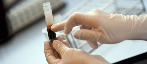 Coronavirus: provoca co&aacute;gulos en la sangre de pacientes graves - infobae.com