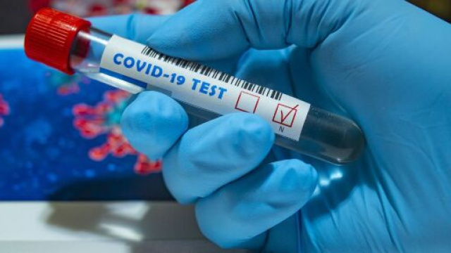 Coronavirus: bollettino della Regione Abruzzo del 7 maggio