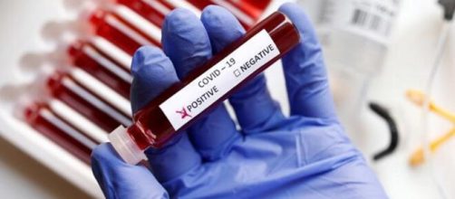 No todos los pacientes de Covid-19 generan anticuerpos.