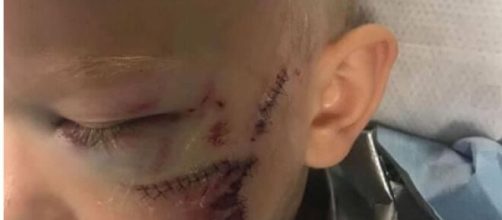 Bridger salva irm&atilde; de ataque de cachorro e leva 90 pontos. (Reprodu&ccedil;&atilde;o/Instagram/@nicolenoelwalker)