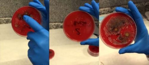 Una m&eacute;dica farmac&eacute;utica demostr&oacute; que las mascarillas que no se lavan o desinfectan con frecuencia pueden tener bacterias