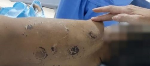 Beb&ecirc; tamb&eacute;m teve costelas fraturadas. (Reprodu&ccedil;&atilde;o/Rede Globo)