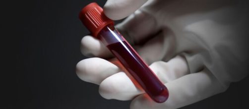 Un nuevo an&aacute;lisis de sangre puede detectar 5 tipos de c&aacute;ncer mucho antes que las pruebas convencionales