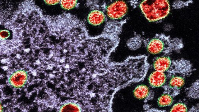 Coronavirus, il bollettino del 5 luglio 2020.