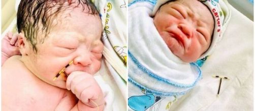 Beb&ecirc; nasce segurando o dispositivo intrauterino (DIU) da m&atilde;e. (Arquivo Blasting News)