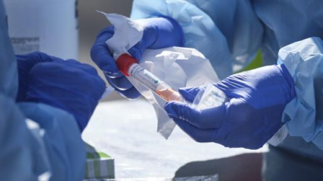 Coronavirus, in tutto il mondo pi&ugrave; di 800 mila morti.