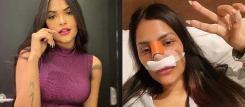 Al&eacute;m de rinoplastia, Flayslane tamb&eacute;m passou pela lipo lad. (Arquivo Blasting News)