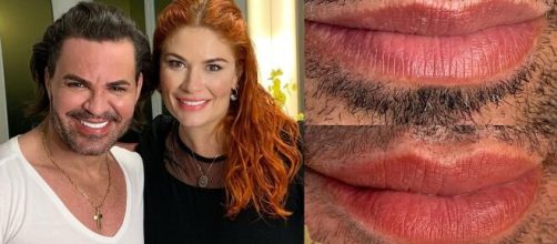 Eduardo Costa diz que passou apenas por uma lipo e aplica&ccedil;&otilde;es de botox. (Arquivo Blasting News)
