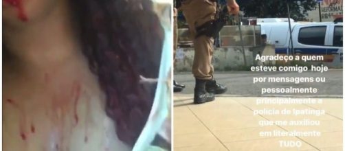 A mulher postou um v&iacute;deo falso onde aparecia chorando e sangrando. (Reprodu&ccedil;&atilde;o/Redes Sociais)