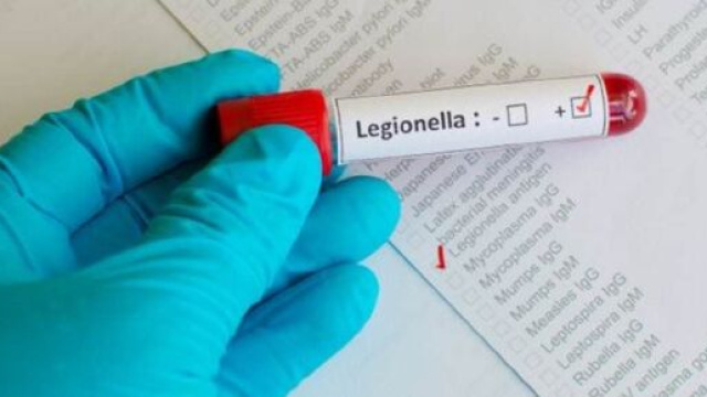 Busto Arsizio, individuati 16 casi di legionella: una vittima.