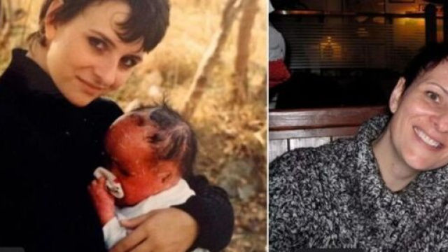 LE B&Eacute;B&Eacute;, ATTEINT D&rsquo;UNE MALADIE DE PEAU RARE, A MAINTENANT 27 ANS (PHOTOS) - photo facebook