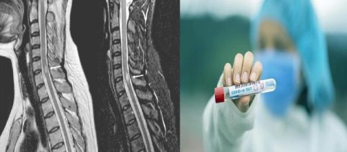 The New York Times se&ntilde;ala a la mielitis transversa como el posible efecto adverso de la vacuna de Oxford