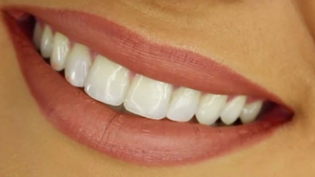 Consigli per avere denti e gengive sani: dal lavarsi i denti all'uso di prodotti con fluoro.