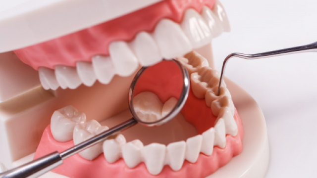 Dentiere: tipologie e costi degli impianti totali o parziali.