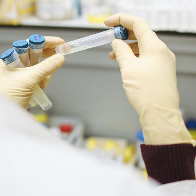 Blasting News ha parlato con Astrid Vabret, professoressa di virologia all'Universit&agrave; di Caen. &copy;Polina Tankilevitch