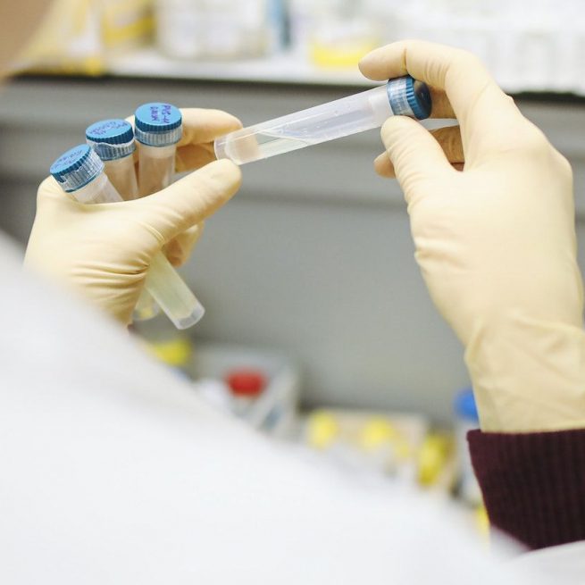 Pr. Vabret on COVID-19: &lsquo;With viruses it's never over. What you can do is learn to live with it&rsquo; &copy;Polina Tankilevitch