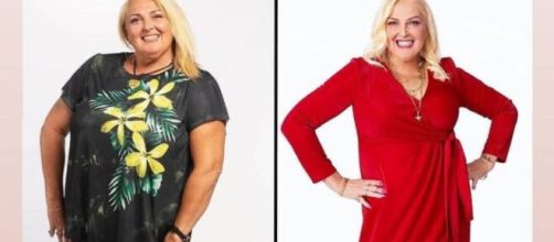 Angela Deem underwent five surgeries in one day (Image source: Instagram/@deemangela)