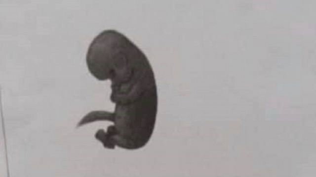 Piacenza, ragazza interrompe la gravidanza, il messaggio in classe: 'Io feto, tu aborto'.
