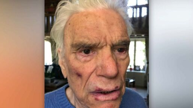 Agression de Bernard et Dominique Tapie : les images d&eacute;voil&eacute;es (Credit Twitter : BFMTV)