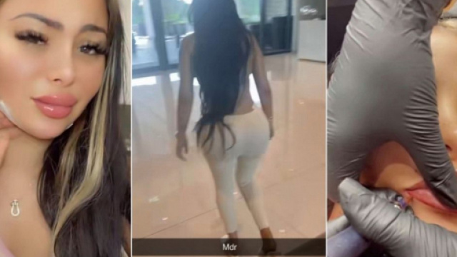 Maeva Ghennam trait&eacute;e de "menteuse" : elle subit plusieurs op&eacute;rations de chirurgie esth&eacute;tique et se fait lyncher par les internautes.