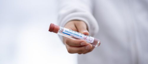 Con esta nueva normativa cualquiera puede comprar una prueba de ant&iacute;genos o de anticuerpos (Pixabay)