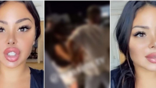 Maeva Ghennam (Les Marseillais vs Le Reste du Monde 6) impliqu&eacute;e dans une violente bagarre &agrave; Mykonos, elle s'explique enfin.