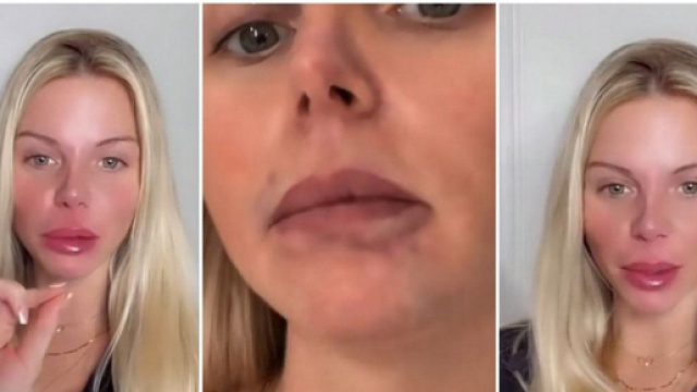 Jessica Thivenin d&eacute;figur&eacute;e par sa nouvelle chirurgie esth&eacute;tique et accus&eacute;e d'&ecirc;tre une mauvaise m&egrave;re, elle r&eacute;pond &agrave; ses haters.