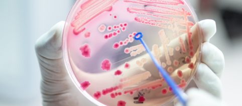 Antibiotico-resistenza: è la seconda causa di morte naturale al mondo