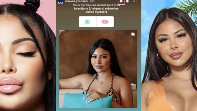 Maeva Ghennam enl&egrave;ve ses injections au visage