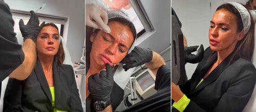 Olga Moreno se somete a un tratamiento est&eacute;tico en el rostro (Capturas Instagram @clinicabruselas)