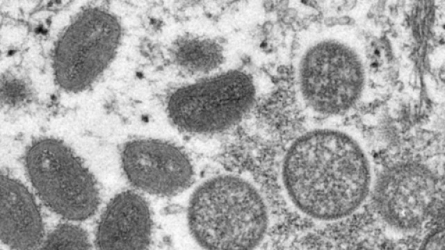 Un'immagine al microscopio del vaiolo delle scimmie. &copy;Russell Regnery/Cdc Cynthia S. Goldsmith