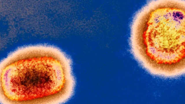 Un'immagine al microscopio del vaiolo delle scimmie.